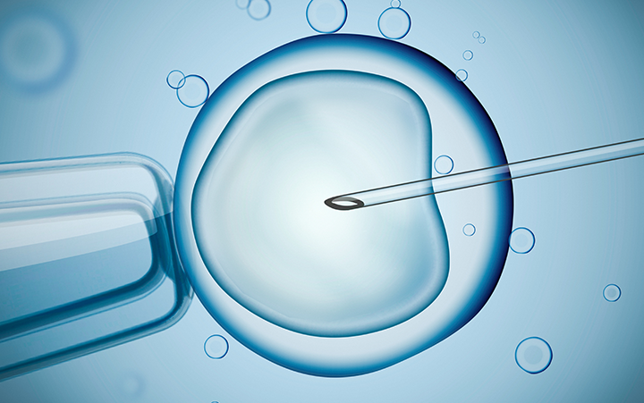 In-Vitro Fertilization IVF process